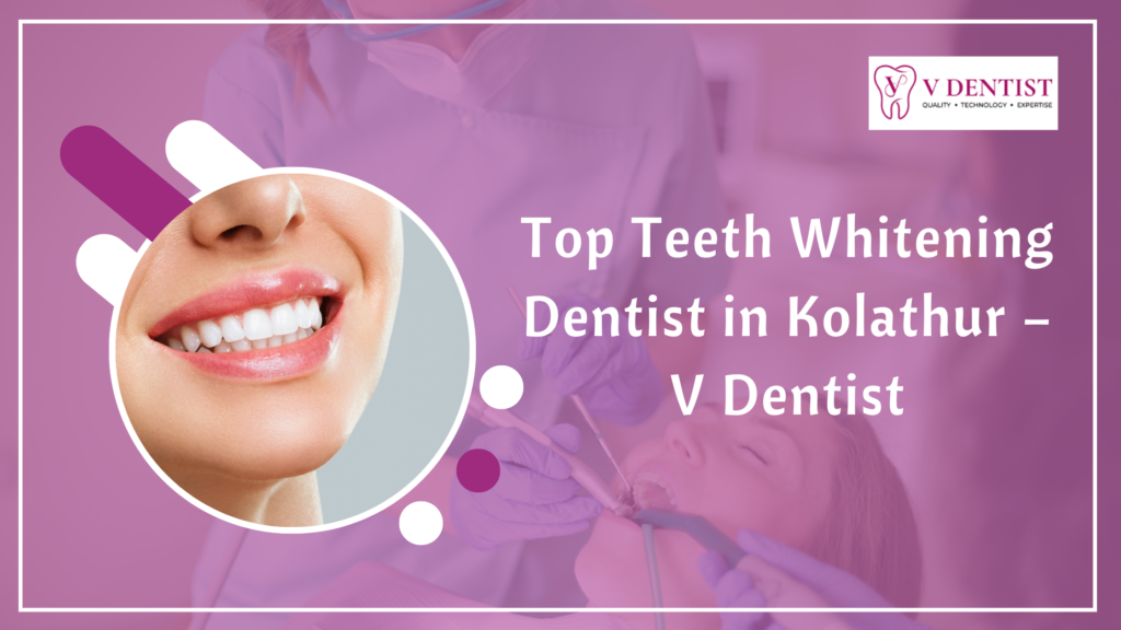 Top Teeth Whitening Dentist in Kolathur – V Dentist