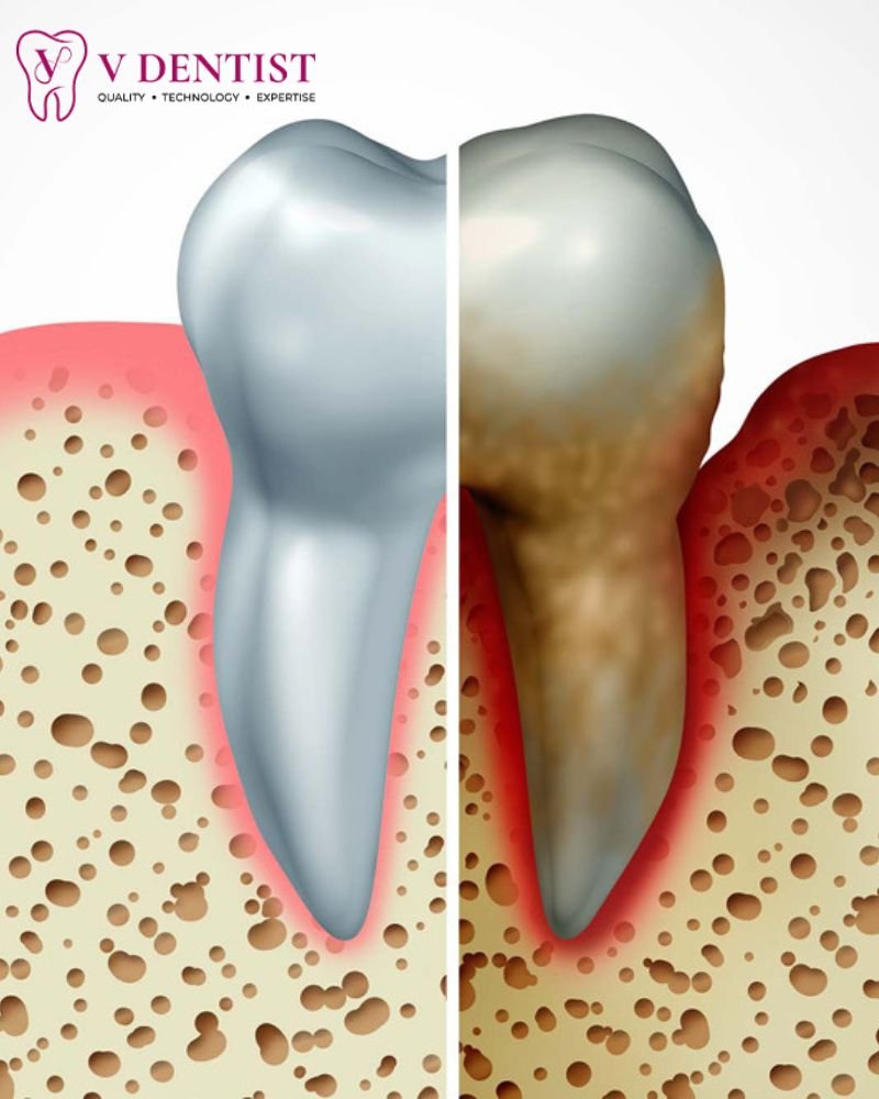 Expert Periodontics in Kolathur
